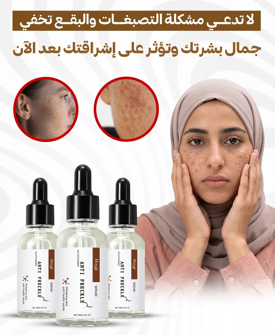 Anti-Freckle Serum 30ml | سيروم للعناية بمظهر البقع والنمش