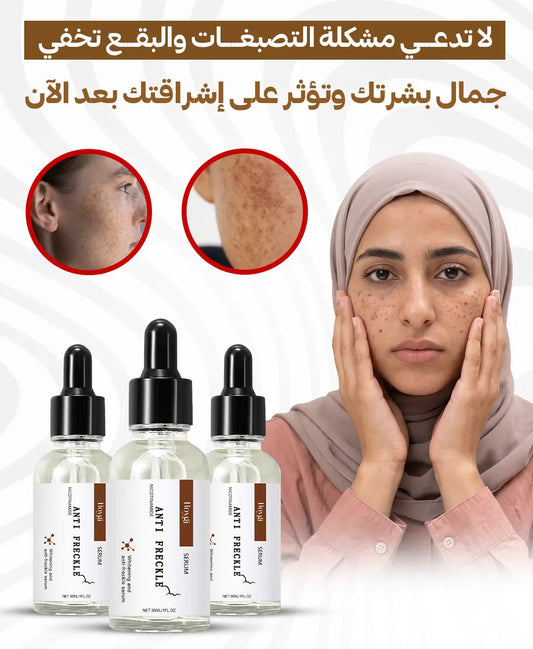 Anti-Freckle Serum 30ml | سيروم للعناية بمظهر البقع والنمش